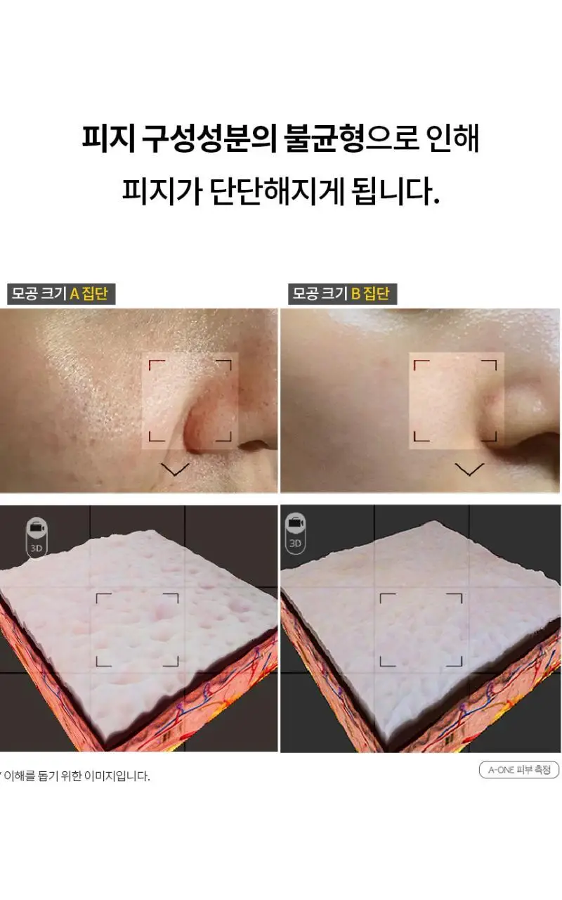 [피지캐는크림] 라돌프 퓨어파지 크림 알엑스 80g 상세페이지 9